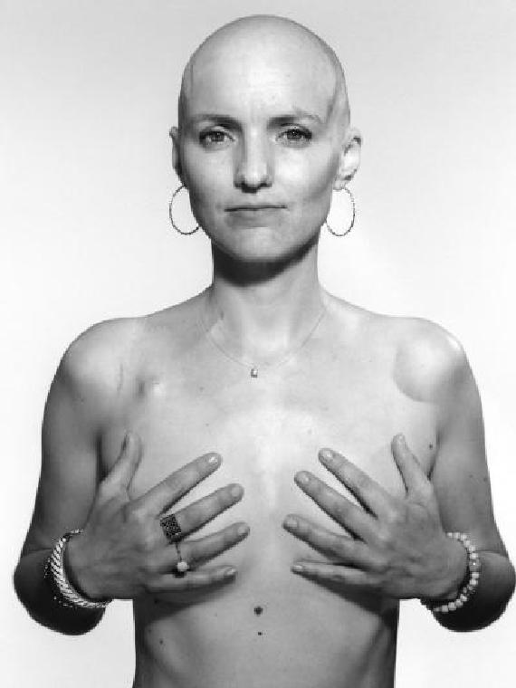 Exposition Des femmes dans la tourmente, portraits de femmes face au cancer 